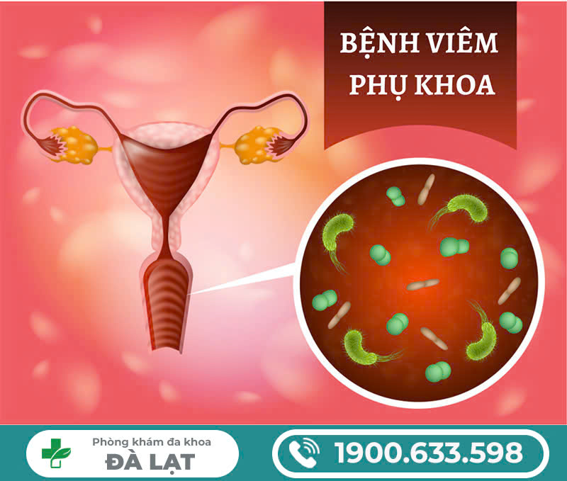 Biến chứng nguy hiểm viêm nhiễm vùng kín nhất định không nên chủ quan